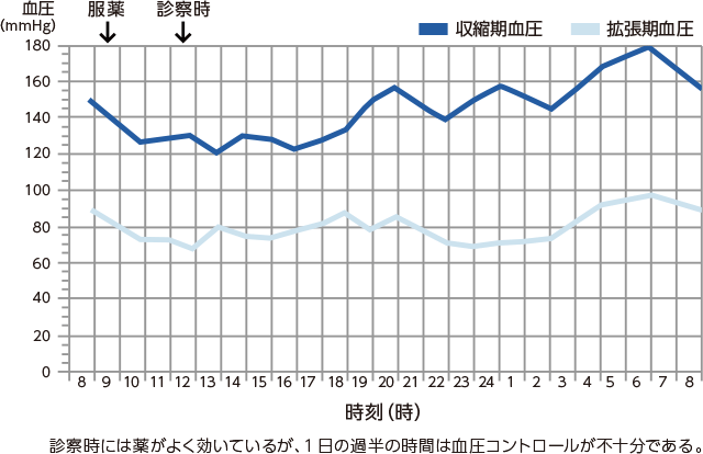 診察時には薬がよく効いているが、1日の過半の時間は血圧コントロールが不十分である。